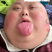 BallZack